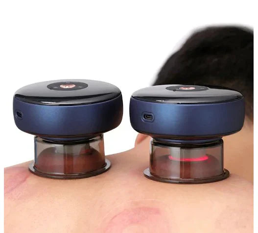 Electric Vacuum Cupping Massager My Store